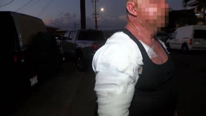 A man says it's a miracle that he survived the New Year's fireworks blast in Aliamanu.