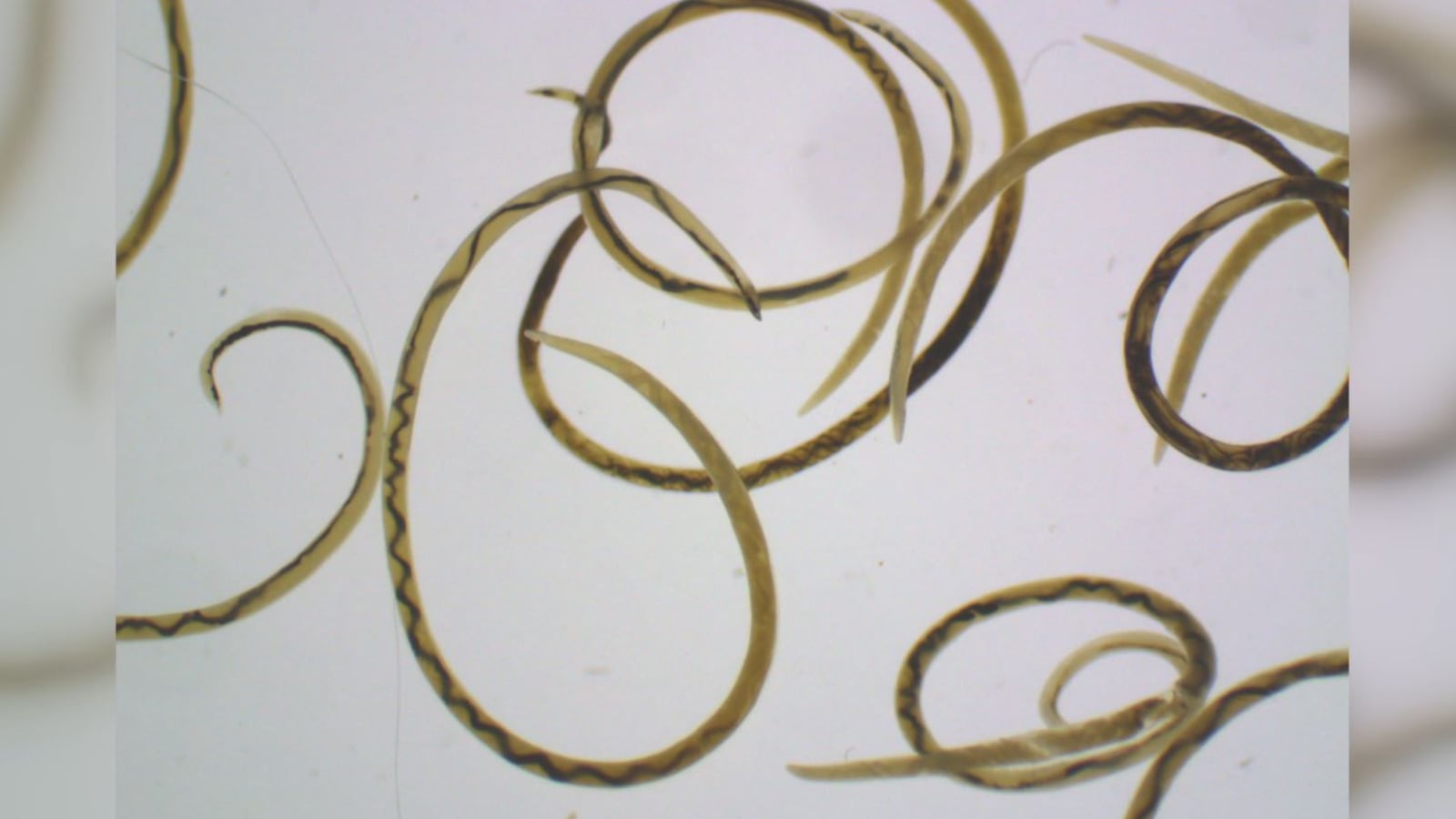 IN-DEPTH: What is rat lungworm disease and how do you prevent it?