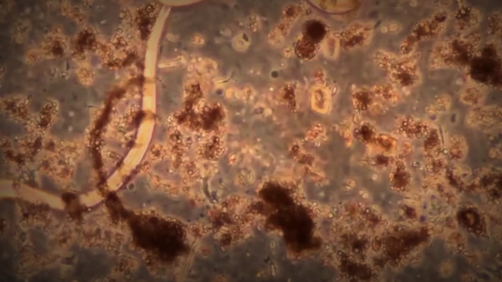 New cases of rat lungworm disease discovered on Hawaii Island