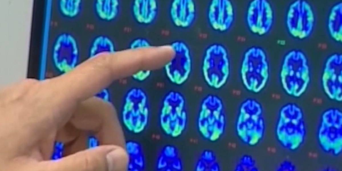 Healthier Hawaii: Warning signs of dementia, tips for healthy aging brains - Hawaii News Now